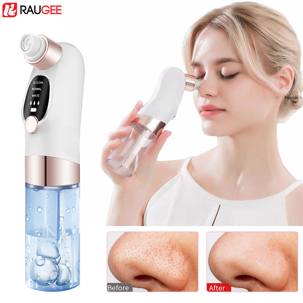 Pore Vacuum - Siyah nokta Remover Elektrikli Siyah Nokta